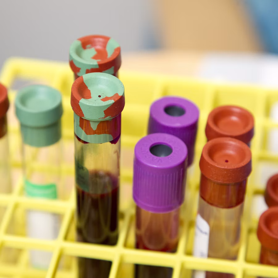 Tubes de sang sur un portoir de laboratoire